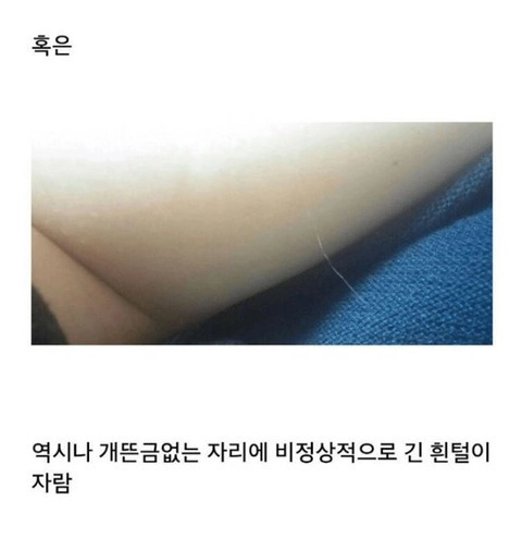 쌩뚱맞은 부위에 자라는 털.jpg